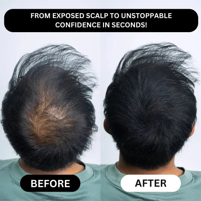 Veronni™️ - Densify