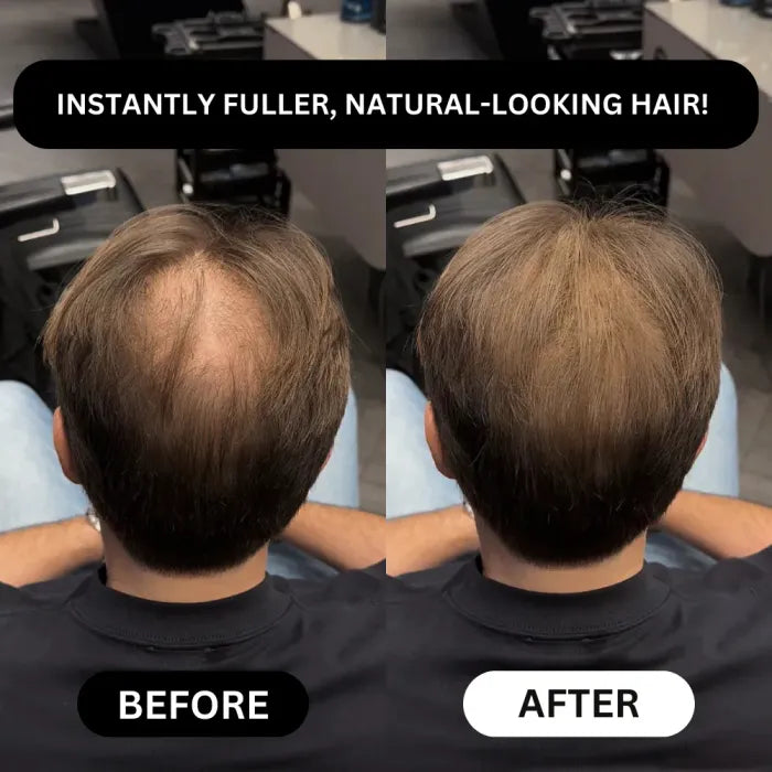 Veronni™️ - Densify